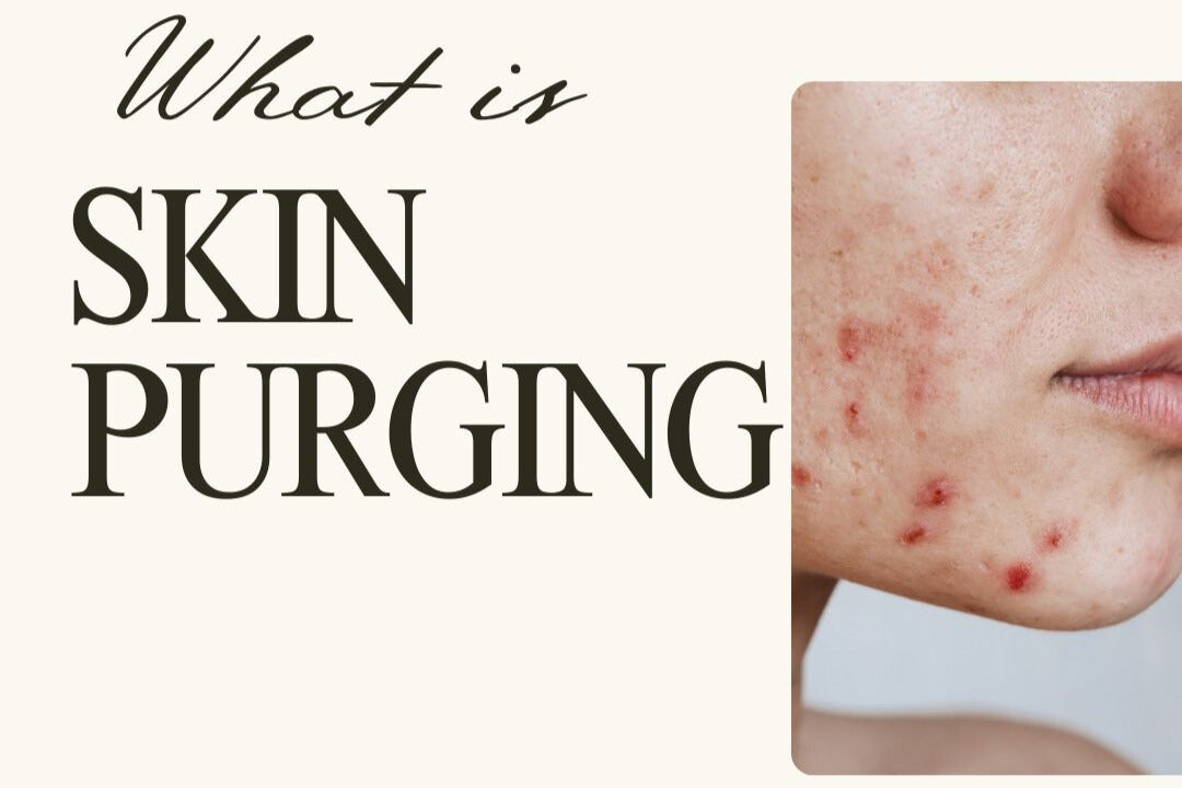 Breakout or Breakthrough? Decoding Your Skin's Purge