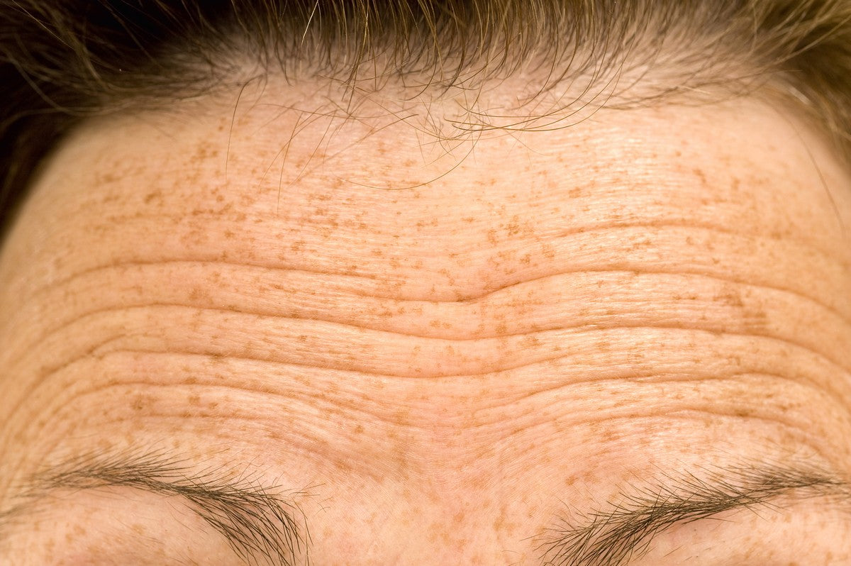 Fine lines vs. wrinkles: what do I have?