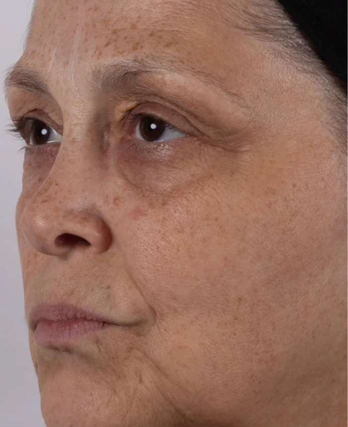 Before using Amrutini Luminosity Dewdrops