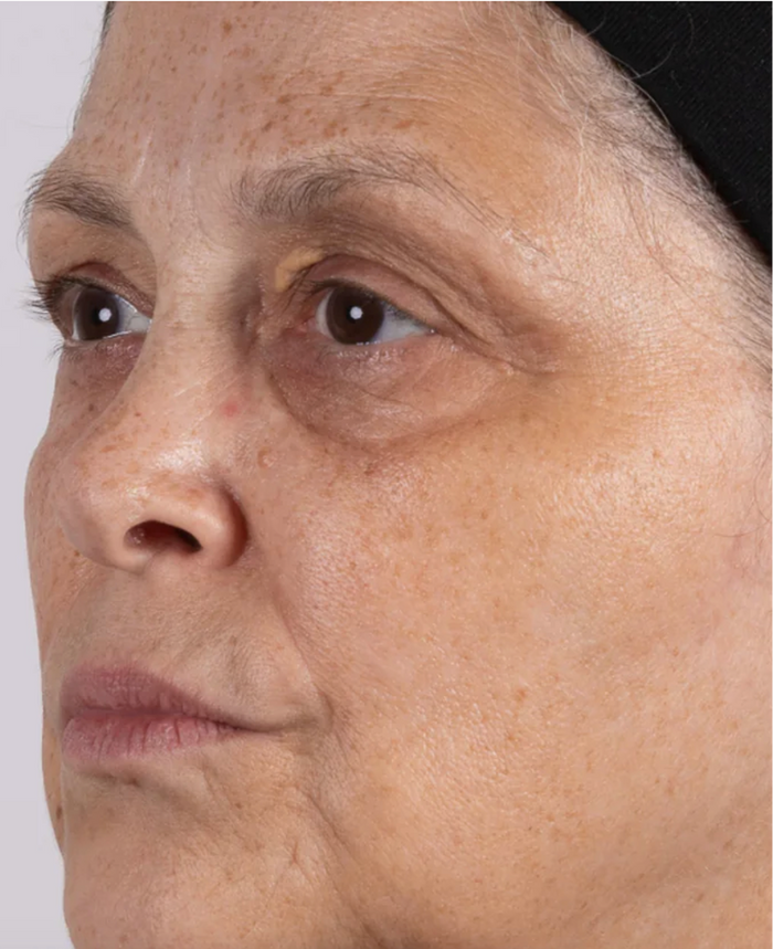After 28 days of using Amrutini Luminosity Dewdrops