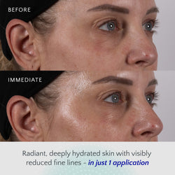Amrutini® Radiance - Home and Away Set - before after