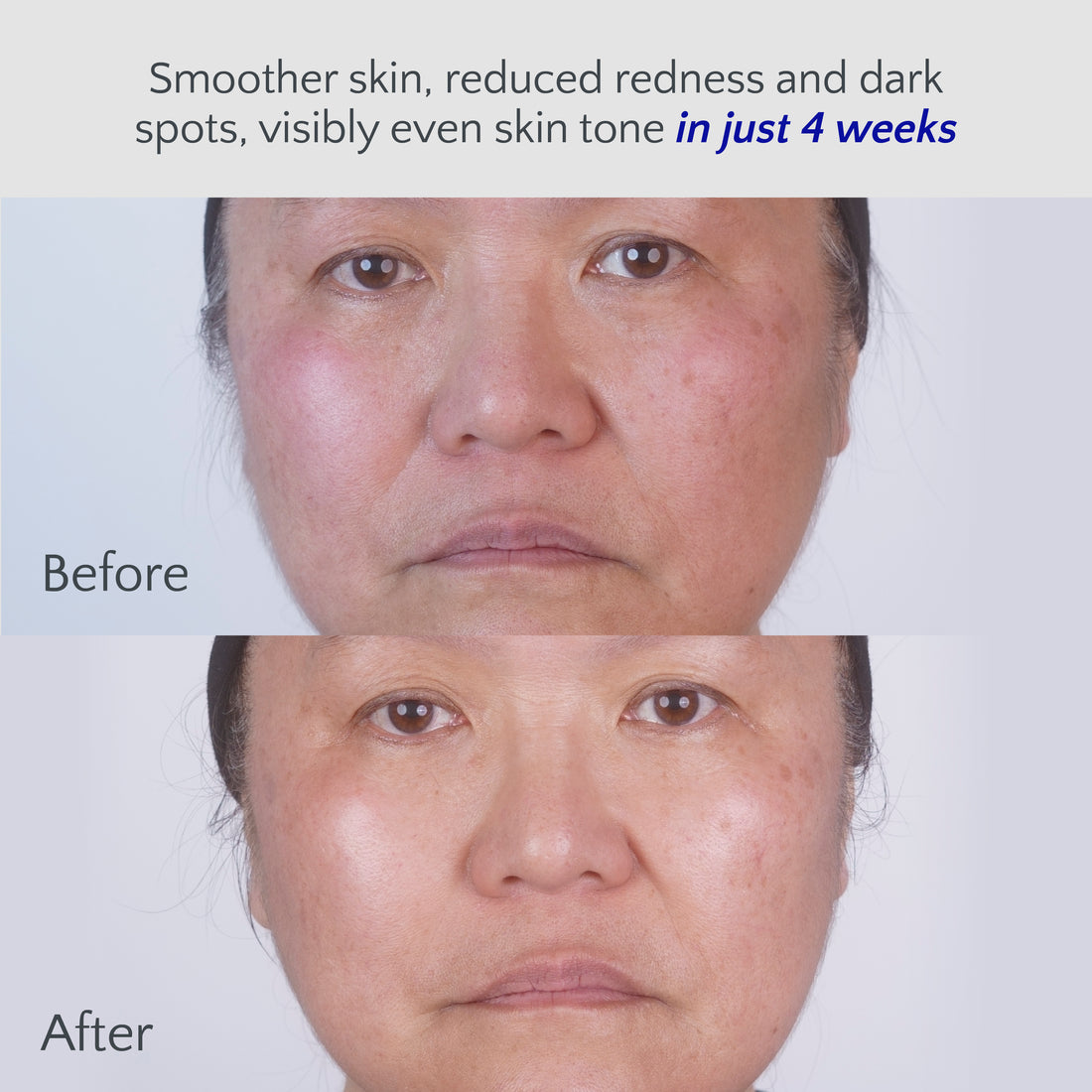 Amrutini® Transforming Serum