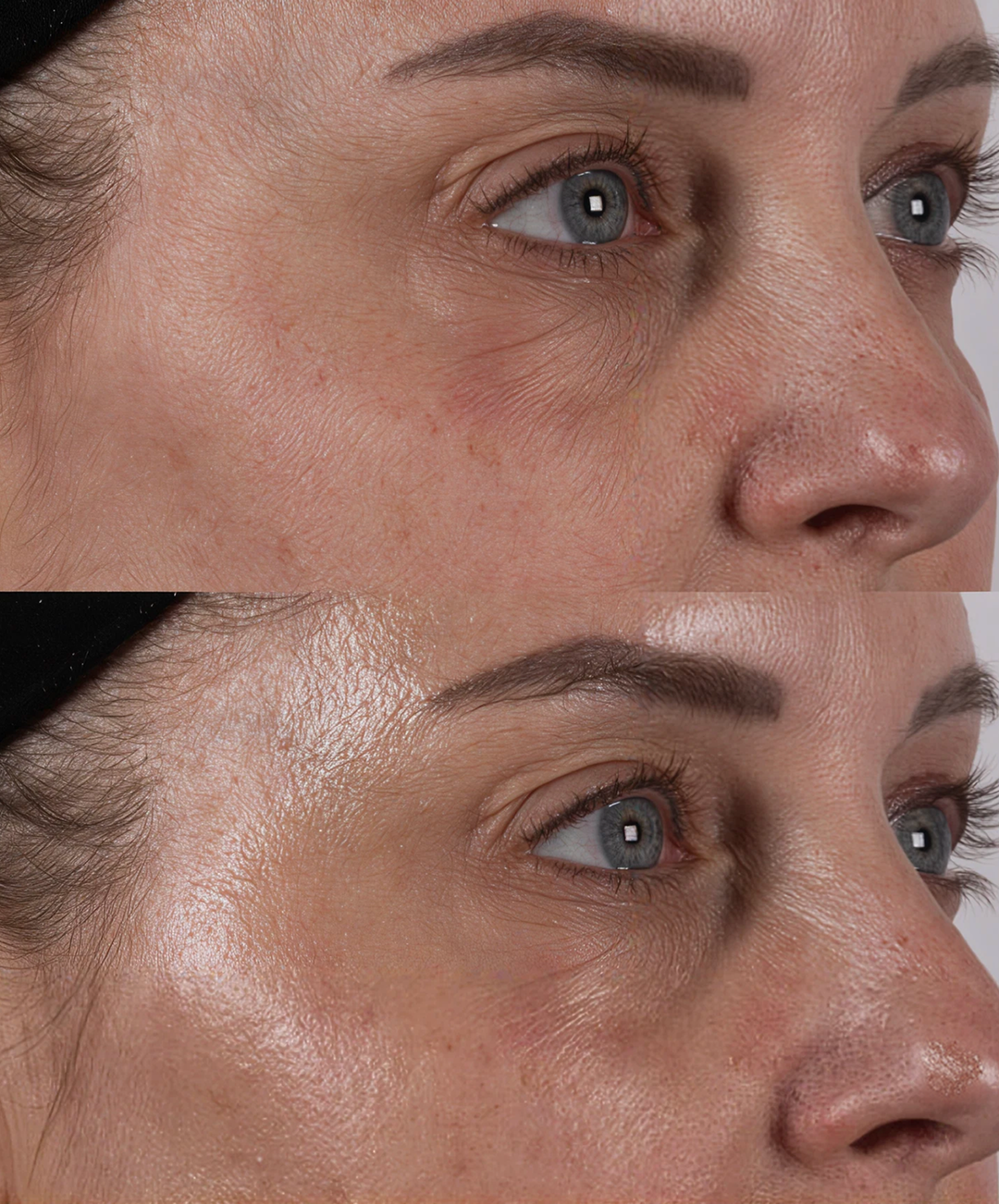 Before and after results with Amrutini Luminosity Dewdrops