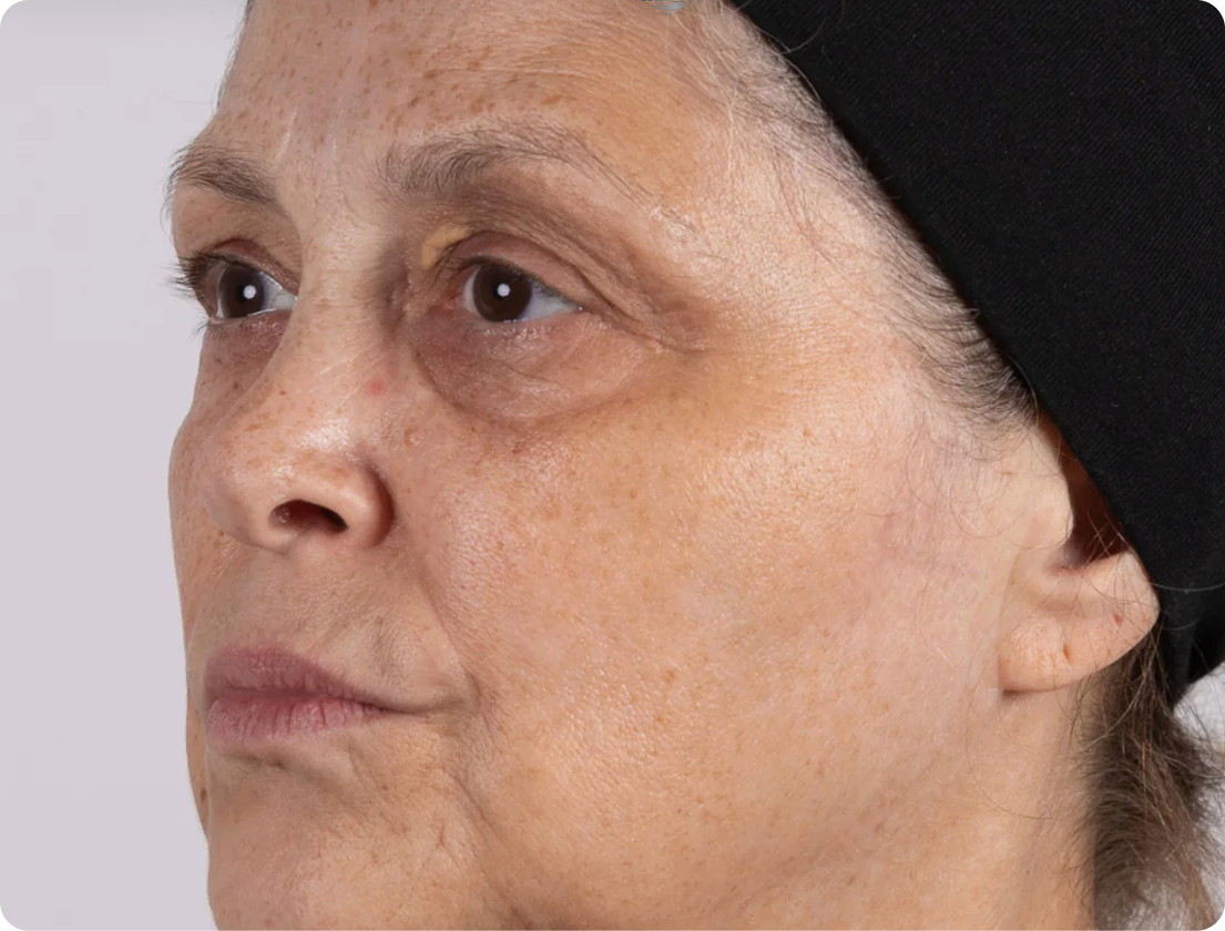 After 28 days of using Amrutini Luminosity Dewdrops